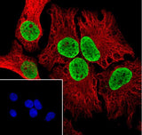Anti-Human/Rat/Mouse Histone H3 (Di Methyl Lys122) Antibody [A844] - ABMIUM