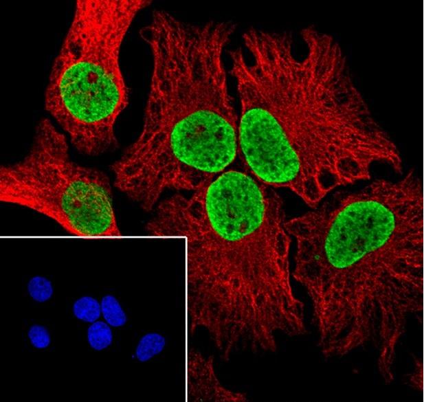 Anti-Human/Rat/Mouse Histone H3 (Di Methyl Lys122) Antibody [A844] - ABMIUM