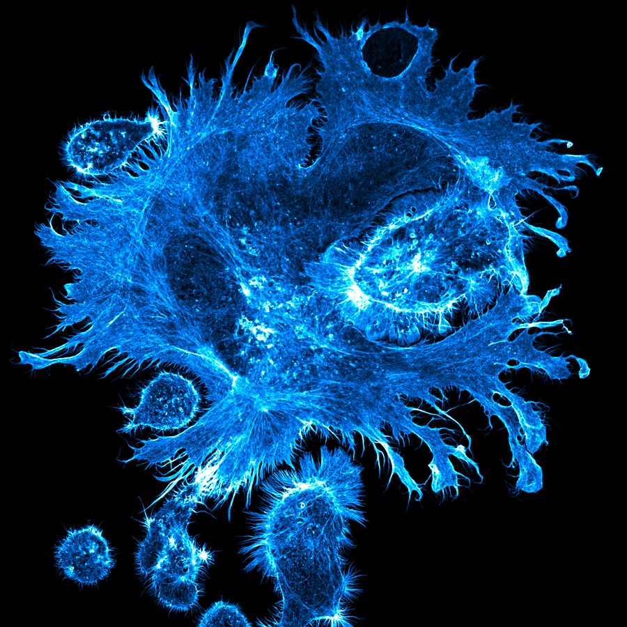 HepAD38 human liver cell surrounded by smaller cells.