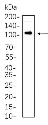 Anti-Human/Mouse/Rat Androgen Receptor Antibody [B562]