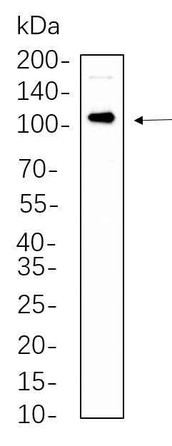 Anti-Human/Mouse/Rat Androgen Receptor Antibody [B562]