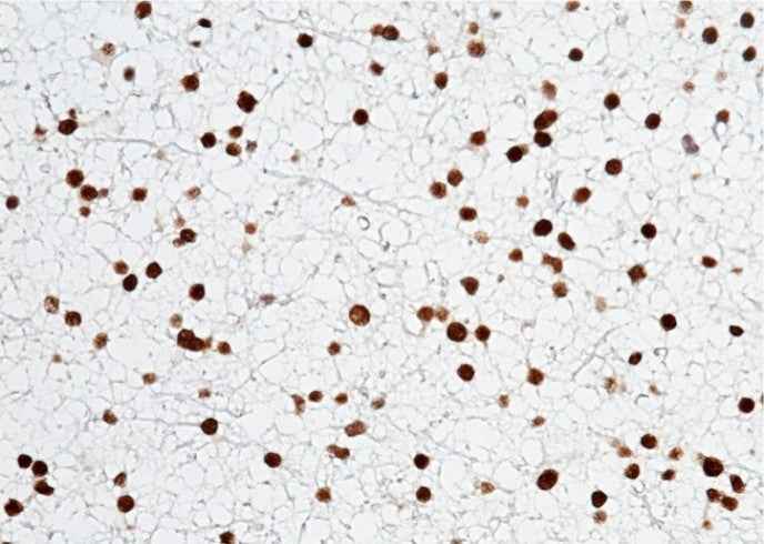 Anti-Human OLIG2 Antibody [A1253] - ABMIUM