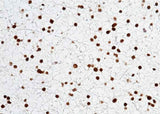 Anti-Human OLIG2 Antibody [A1253] - ABMIUM