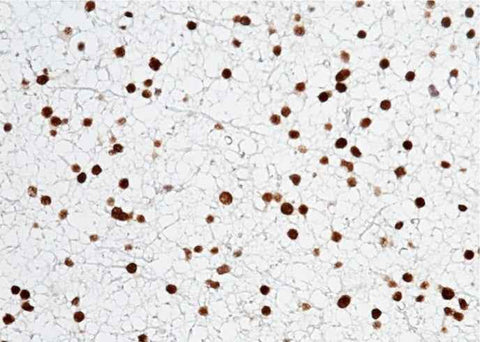 Anti-Human OLIG2 Antibody [A1253] - ABMIUM