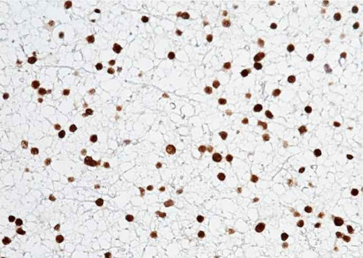 Anti-Human OLIG2 Antibody [A1253] - ABMIUM