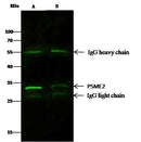 Anti-Human PSME2 Antibody [A932] - ABMIUM