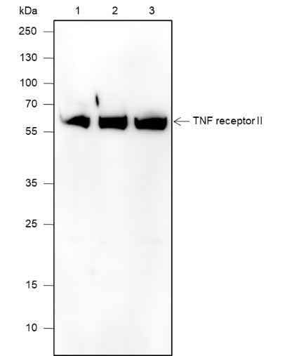 Anti-Human/Mouse TNF receptor II Antibody [A604] - ABMIUM
