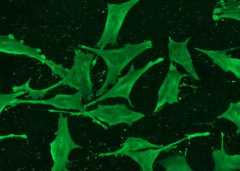 Anti-Human ISG15 Antibody [A1241] - ABMIUM