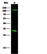 Anti-Human IL17RA Antibody [A959] - ABMIUM