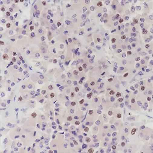 Anti-Human PITX2/RGS Antibody [A334] - ABMIUM