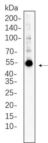 Anti-Human/Mouse/Rat Fascin Antibody [B533]