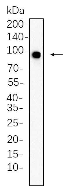 Anti-Human/Mouse/Rat IGF1R Antibody [B1062] - ABMIUM
