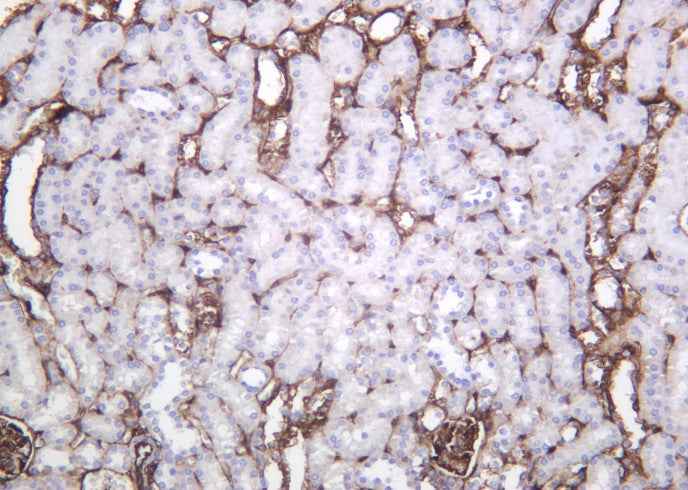 Anti-Human/Mouse/Rat Annexin II Antibody [B1033]