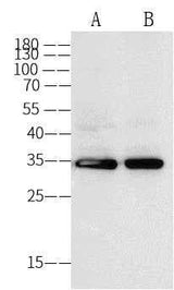 Anti-Human ANXA5 Antibody [A906] - ABMIUM