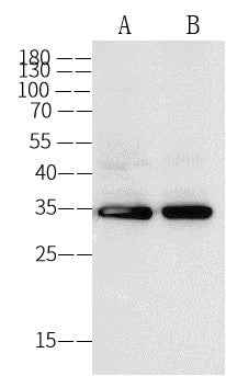 Anti-Human ANXA5 Antibody [A906] - ABMIUM