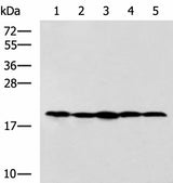 Western blot analysis of Jurkat NIH/3T3 Raji 231 and A172 cell lysates using RPS11 Polyclonal Antibody at dilution of 1:700