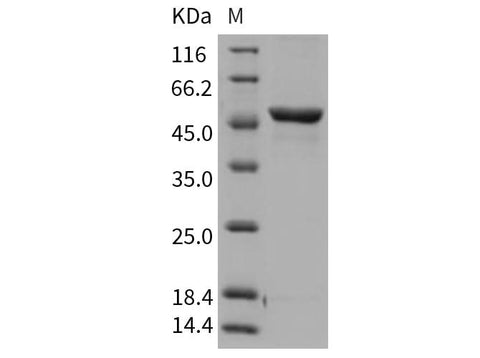 Recombinant Rat GPT1/GPT Protein (His Tag) - ABMIUM
