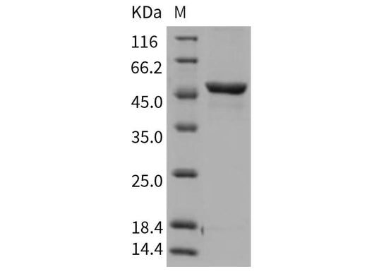 Recombinant Rat GPT1/GPT Protein (His Tag) - ABMIUM