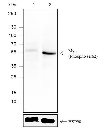 Anti-Human Phospho-c-Myc (Ser62) Antibody [A816] - ABMIUM
