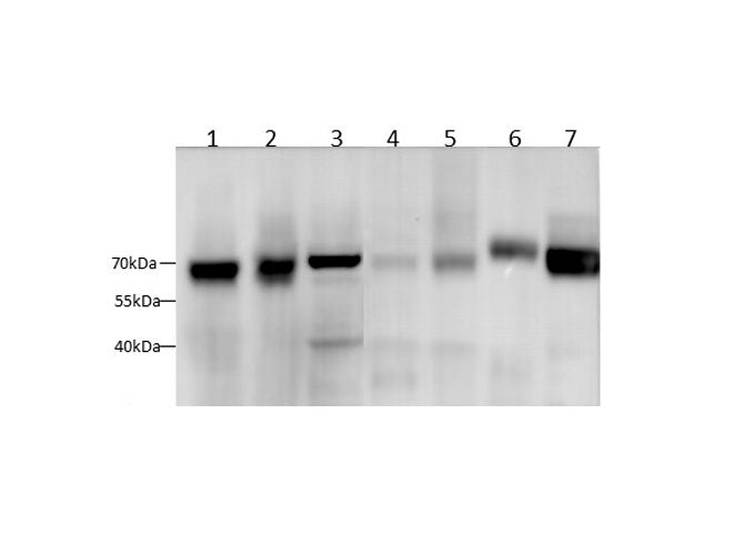 Western blot with SDHA Polyclonal antibody at dilution of 1:1000.lane 1:MCF-7 whole cell lysate,lane 2:Hep G2 whole cell lysate,lane 3:Hela whole cell lysate,lane 4:Mouse brain,lane 5:Mouse kidney,lane 6: Rat brain,lane 7:Rat kidney