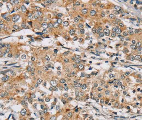 Anti-Human/Mouse RAB24 Antibody