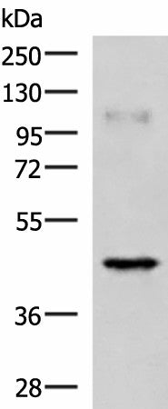 Western blot analysis of Human muscle tissue lysate using RAB3IL1 Polyclonal Antibody at dilution of 1:1000
