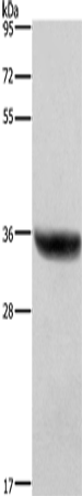 Anti-Human HSD17B1 Antibody - ABMIUM
