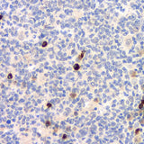 Immunohistochemistry analysis of paraffin-embedded human tonsil using CD284 Polyclonal Antibody at dilution of 1:500.