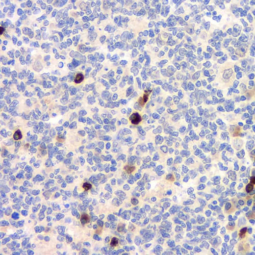 Immunohistochemistry analysis of paraffin-embedded human tonsil using CD284 Polyclonal Antibody at dilution of 1:500.