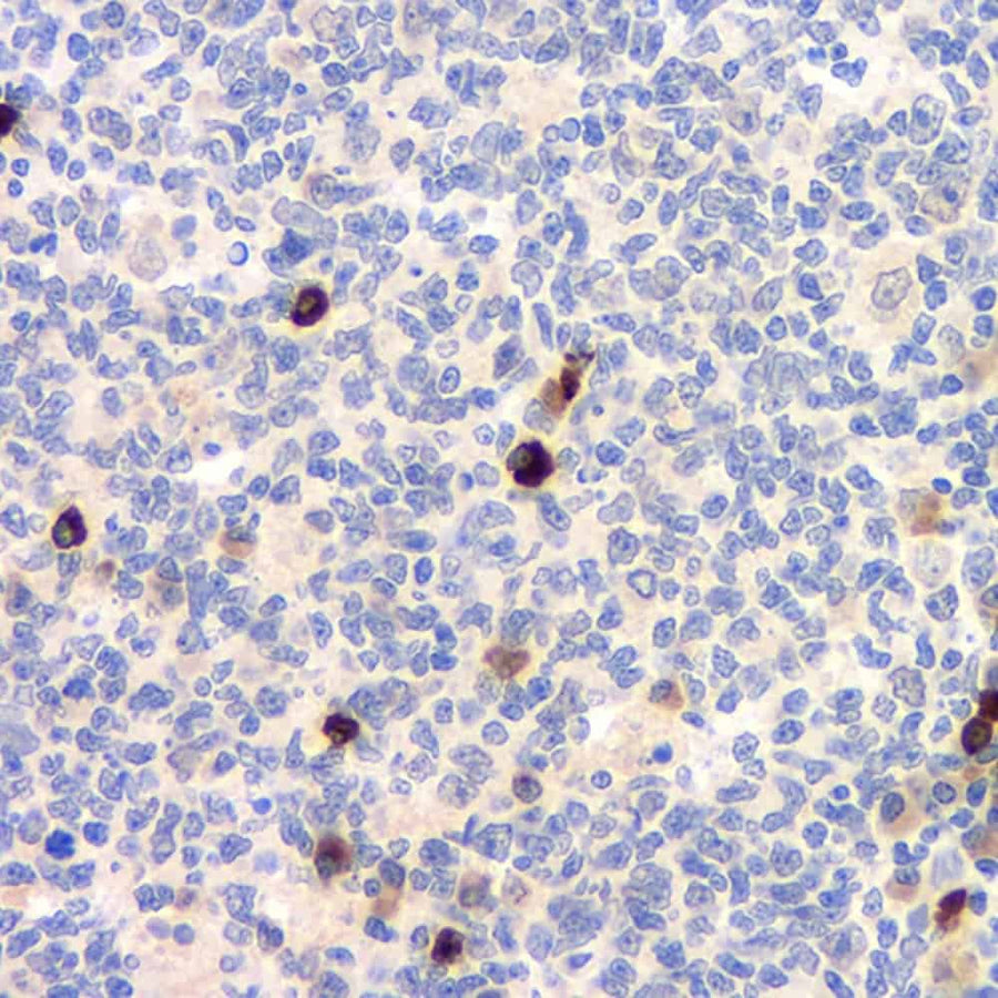 Immunohistochemistry analysis of paraffin-embedded human tonsil using CD284 Polyclonal Antibody at dilution of 1:500.