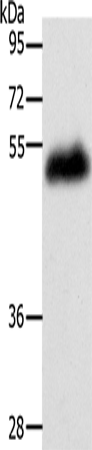 Anti-Human/Mouse/Rat LOX Antibody - ABMIUM