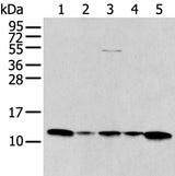 Western blot analysis of A431 Jurkat Lovo and Hepg2 cell Human breast cancer tissue lysates using CCL1 Polyclonal Antibody at dilution of 1:400