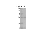 SDS-PAGE analysis of Mouse CXCL3/CINC-2α/β proteins, 2 μg/lane of Recombinant Mouse CXCL3/CINC-2α/β proteins was resolved with SDS-PAGE under reducing conditions, showing bands at 30 kDa.