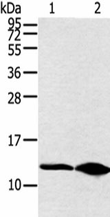 Western blot analysis of Hela cell and human fetal brain tissue using DYNLL2 Polyclonal Antibody at dilution of 1:250