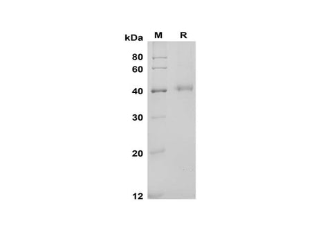 SDS-PAGE analysis of Mouse IL-17 RB proteins, 2 μg/lane of Recombinant Mouse IL-17 RB proteins was resolved with SDS-PAGE under reducing conditions, showing bands at 41 kDa.