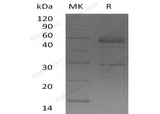 Recombinant Human Semenogelin-1/SEMG1 Protein (His Tag) - ABMIUM