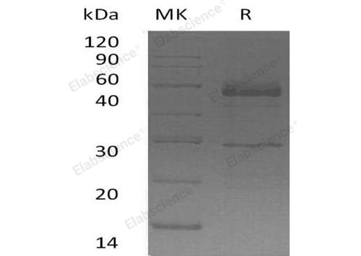 Recombinant Human Semenogelin-1/SEMG1 Protein (His Tag) - ABMIUM