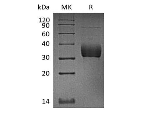 Recombinant Cynomolgus Sialic acid-binding Ig-like lectin 15/Siglec-15/CD33L3 (C-6His) - ABMIUM