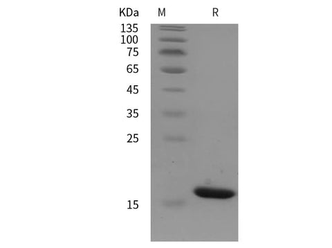 SDS-PAGE analysis of Human ubc/Polyubiquitin-C proteins, 2 μg/lane of Recombinant Human ubc/Polyubiquitin-C proteins was resolved with SDS-PAGE under reducing conditions, showing bands at 16 kDa.