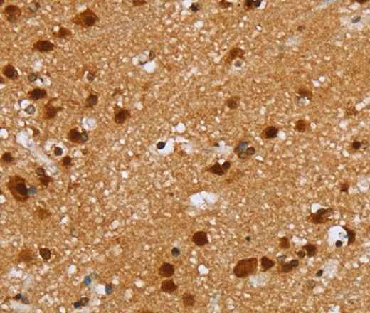 Anti-Human/Mouse/Rat ZMAT3 Antibody