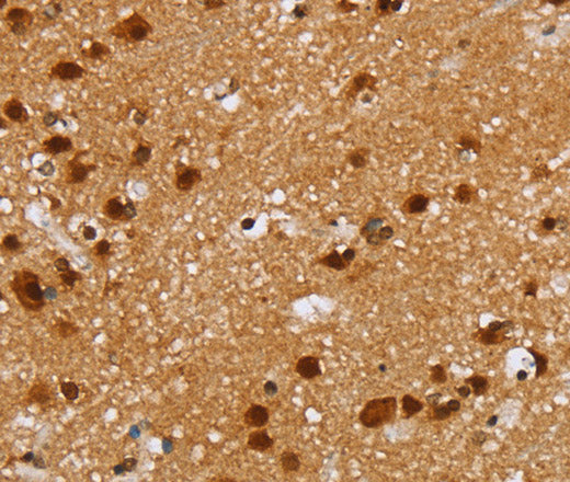 Anti-Human/Mouse/Rat ZMAT3 Antibody - ABMIUM