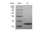 Recombinant Human FABP5 Protein (His Tag) - ABMIUM