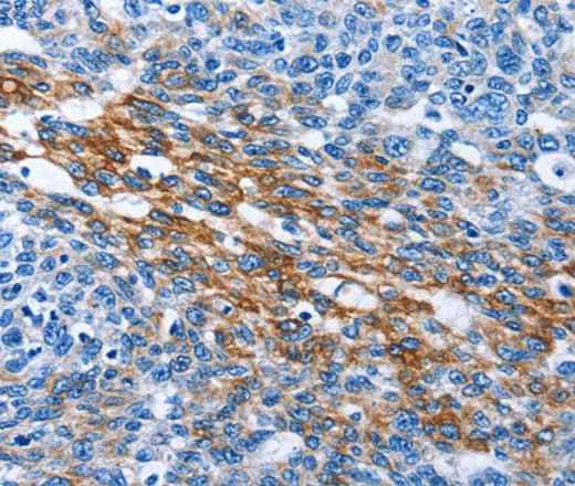 Anti-Human/Mouse PAK6 Antibody