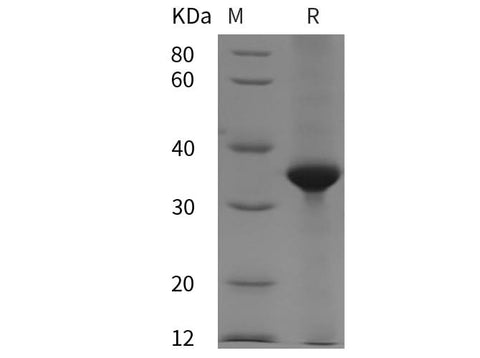 SDS-PAGE analysis of Human MCM3 proteins, 2 μg/lane of Recombinant Human MCM3 proteins was resolved with SDS-PAGE under reducing conditions, showing bands at 35 kDa.