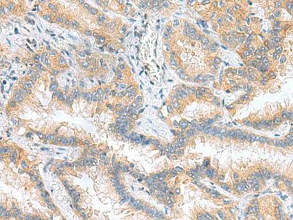 Anti-Human/Mouse/Rat RPS16 Antibody