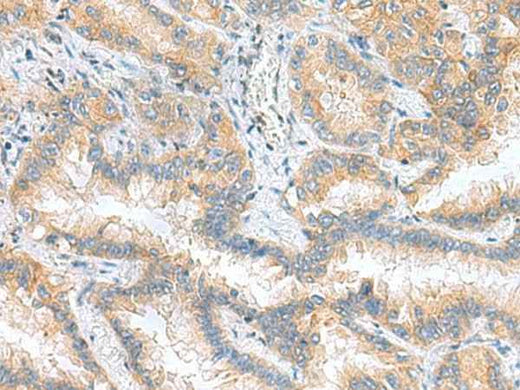 Anti-Human/Mouse/Rat RPS16 Antibody