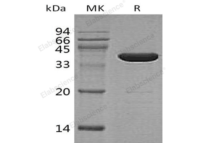 Recombinant Human GABA Protein (GST Tag) - ABMIUM