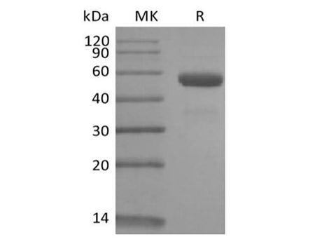 Recombinant Rhesus Macaque CD79B/B29 (C-Fc) - ABMIUM