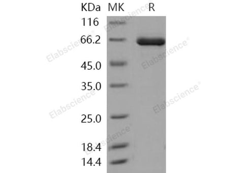 Recombinant Human TLK2/PKU-ALPHA Protein (His&GST Tag) - ABMIUM