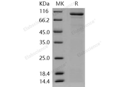 > 82 % as determined by reducing SDS-PAGE.